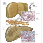 Pathology Charts