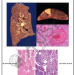 Pathology Charts