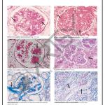 Pathology Charts