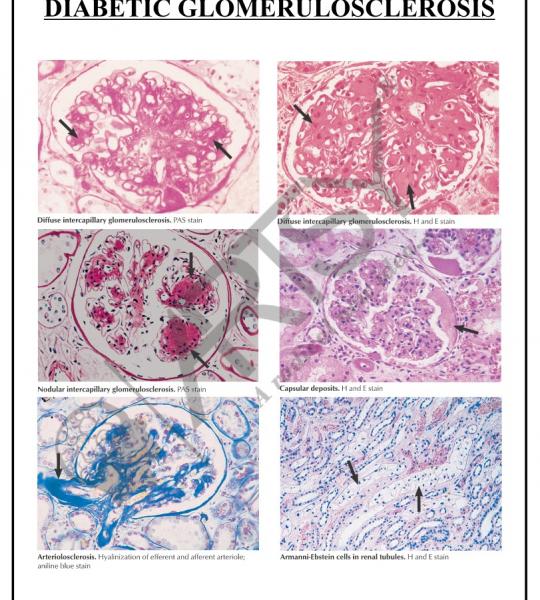Pathology Charts