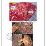 Pathology Charts