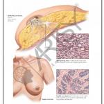 Pathology Charts