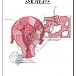 Pathology Charts
