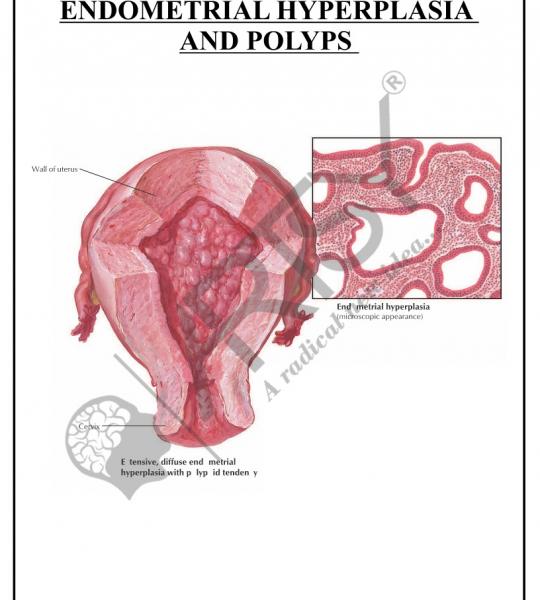 Pathology Charts
