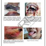 FMT Forensic Chart