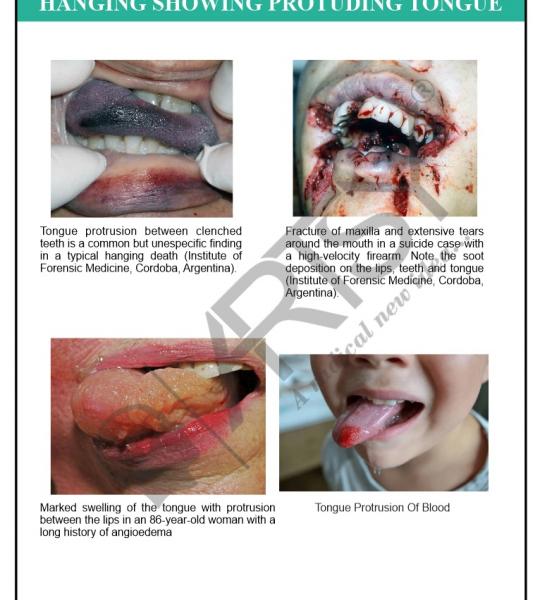 FMT Forensic Chart