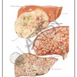 Pathology Charts