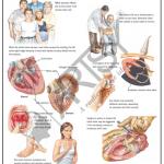 Community Medicine Charts