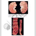 Pathology Charts