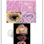 Pathology Charts