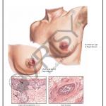 Pathology Charts