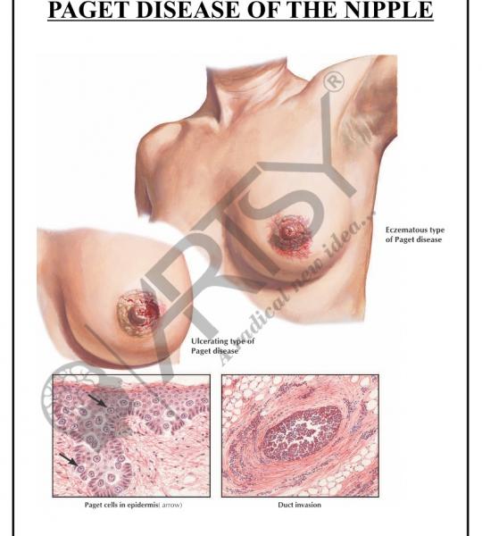 Pathology Charts