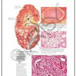Pathology Charts