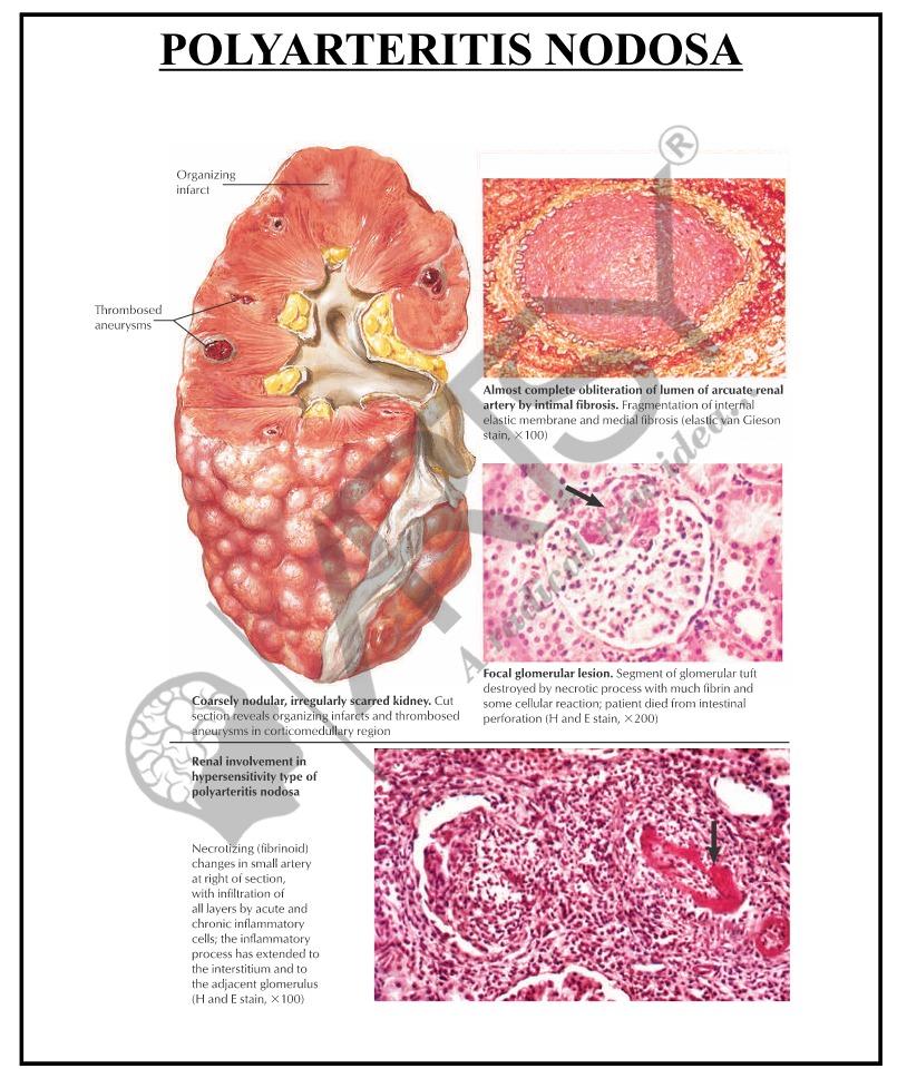 Pathie Pathology Charts