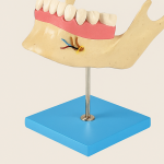 Adult Lower Jaw Model – 18-Year-Old