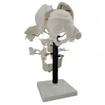 Exploded Human Skull Model