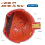 Eye Model, 5 times full-size, 6 part | Medical-Grade Teaching Models