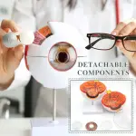 Human Eye Model (6 Times Enlarged) With 7 Dissectible Parts
