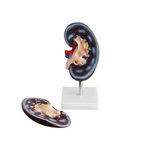 Human Kidney Anatomical Model Showing Renal Pelvis, Ureter, Renal Blood Vessels & Renal Hilus