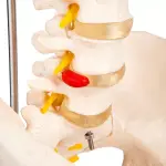 Human Spine Model (Life-Size) With Femur Heads & Pelvis