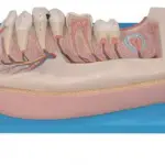 Pediatric Lower Jaw Model – 12-Year-Old