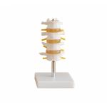 Lumbar Vertebrae Model (4pcs) Life Size