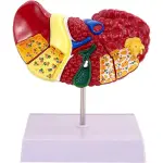 Advanced Pathological Liver Model