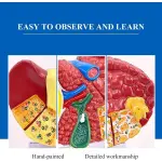 Advanced Pathological Liver Model