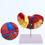 Advanced Pathological Liver Model