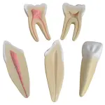 Human Teeth Expansion Model