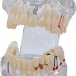 Transparent Milk Teeth Development Model