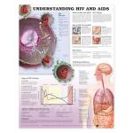 Understanding HIV and AIDS Chart (52x70cm) With Special Rigid Lamination and Plastic Rollers
