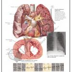 Pathology Charts