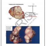 Pathology Charts