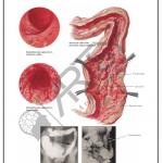 Pathology Charts