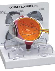 1019535_01_1200_1200_Cornea-Eye-Cross-Section