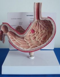 162708900_diseased_stomach_model_gastric_ulcer_model_s