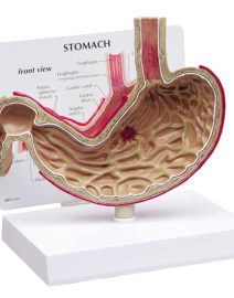 stomach-ulcers-model-1