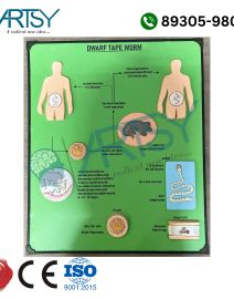 tapeworm model